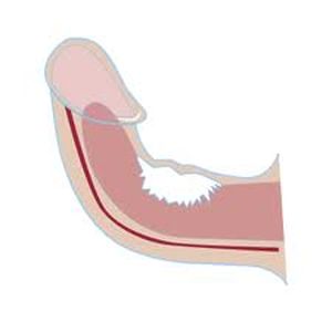 La crema para el aumento del miembro developpe sex