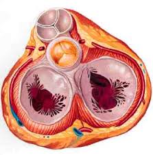 Lesiones valvulares